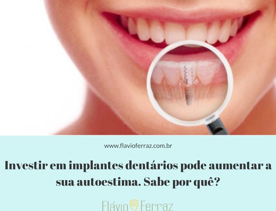 implante_dentario_Flavio_Ferraz
